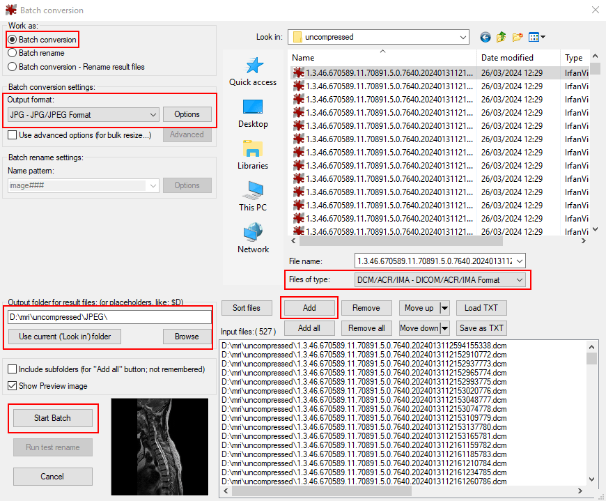 Image of IrfanView Batch Conversion window illustrating how to batch convert DCM files into JPG format.